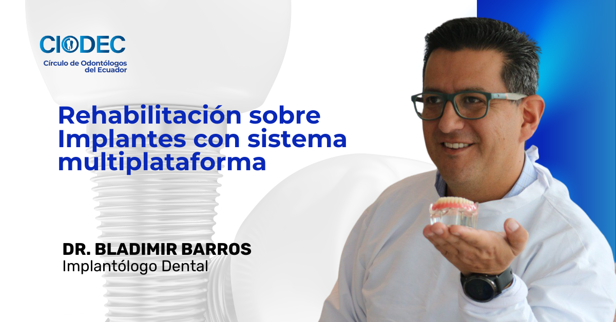 Webinar: Rehabilitación sobre implantes con sistema multiplataforma